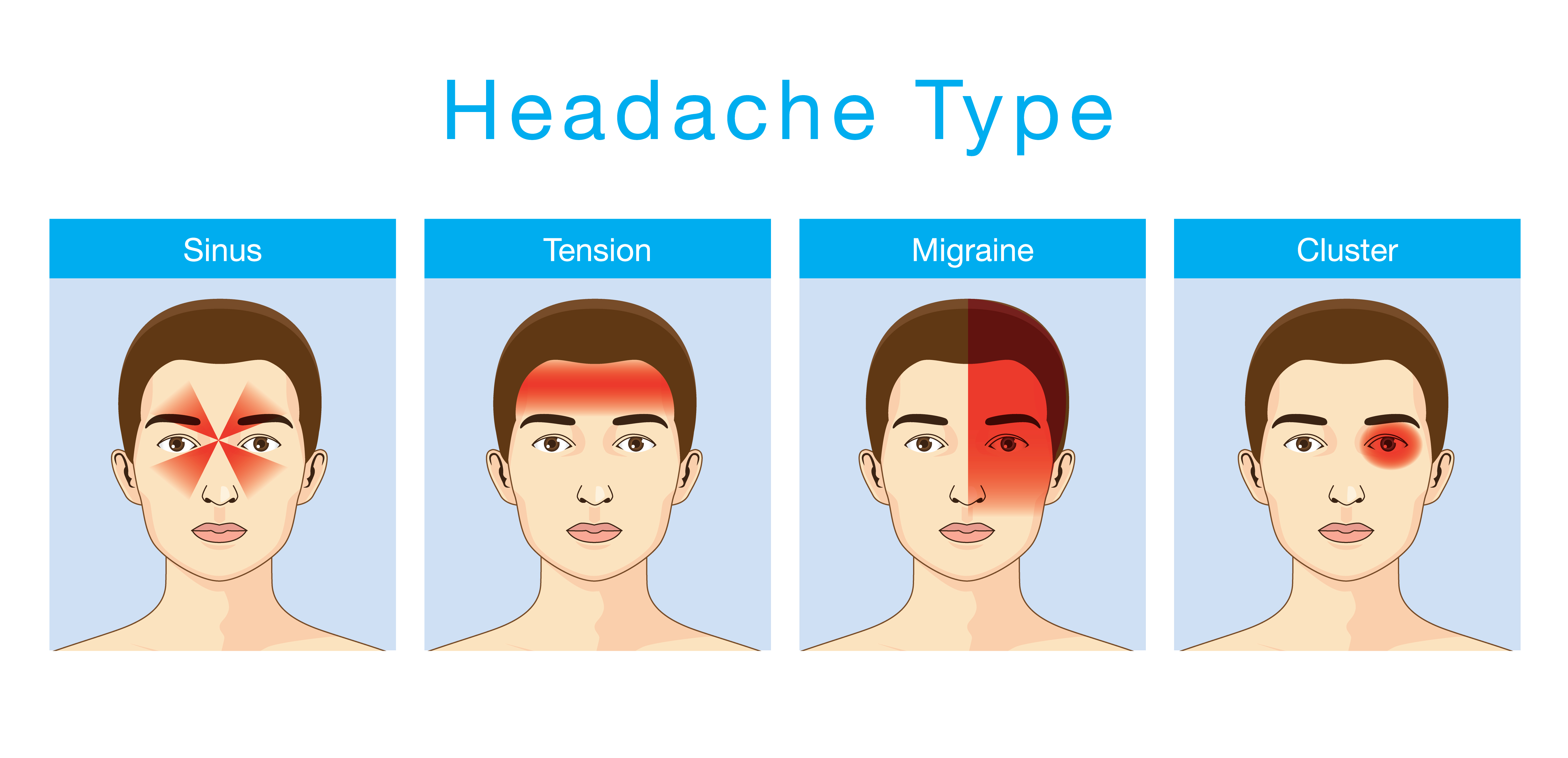 Types Of Headaches Chart Image