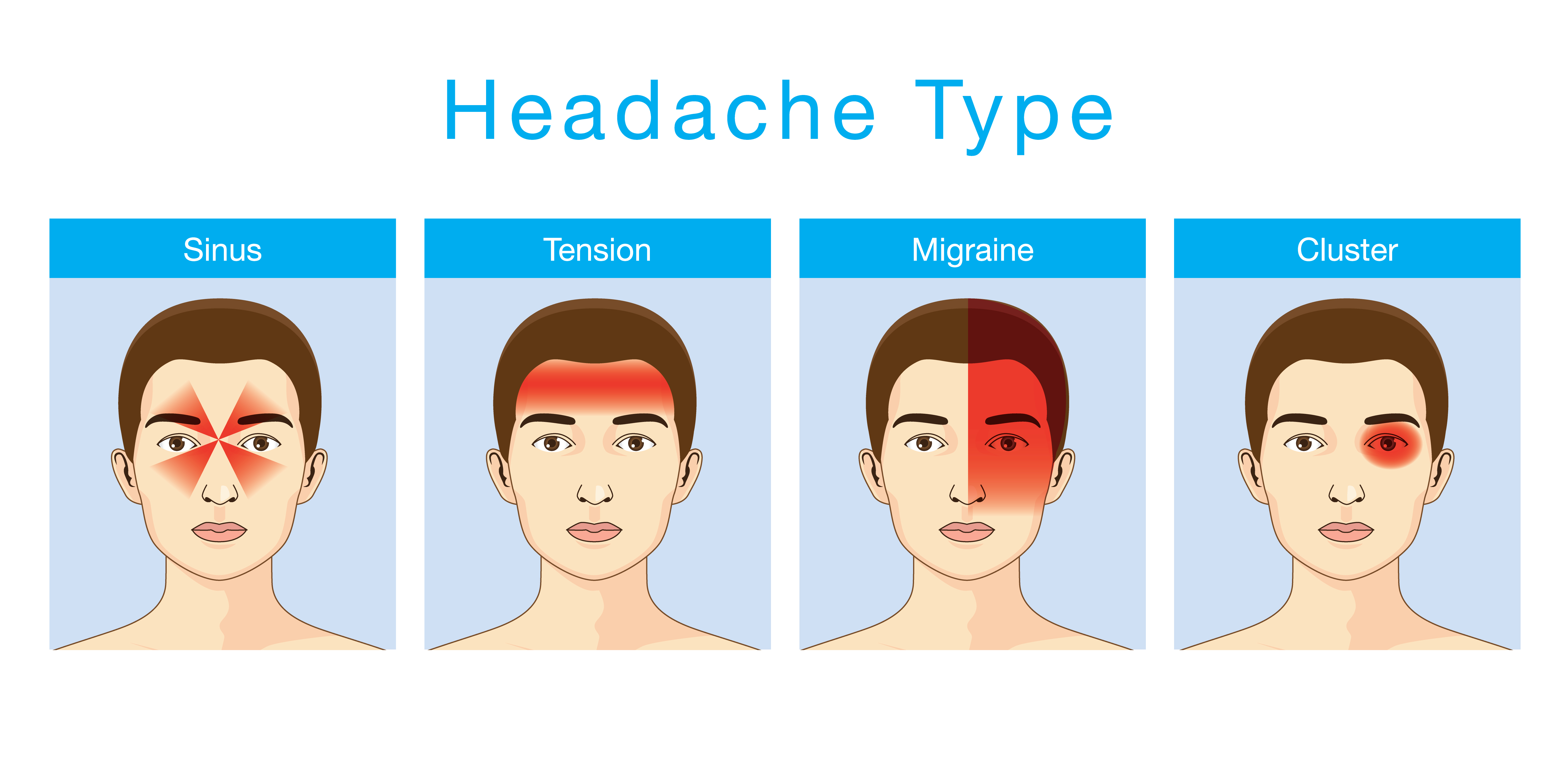 Types Of Headaches Sinus Headache Caused By Sinus Infection 